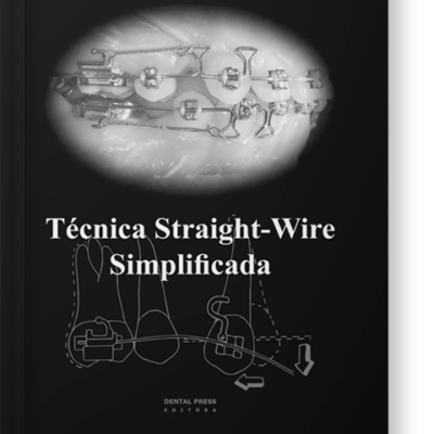 Técnica Straight - Wire Simplificada