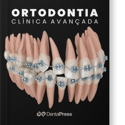 Ortodontia Clínica Avançada