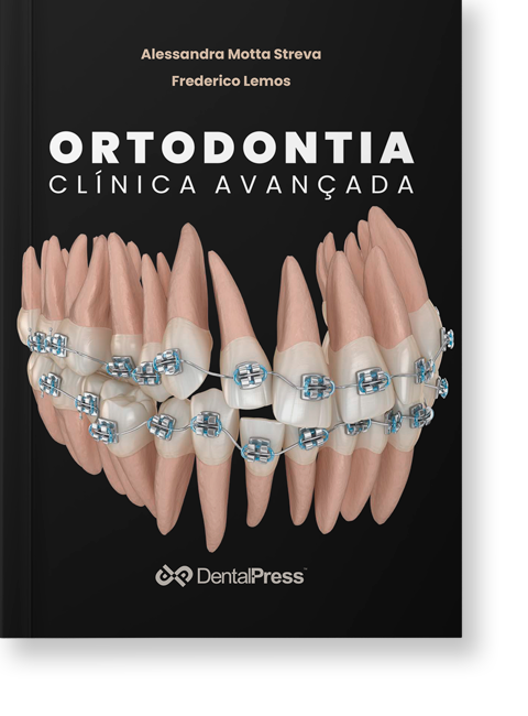 Ortodontia Clínica Avançada
