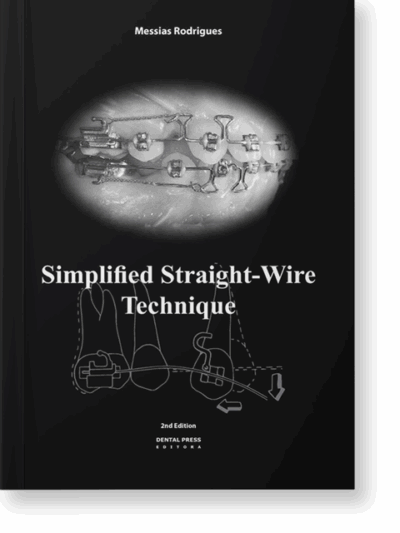 Slimplified Straight-Wire Technique