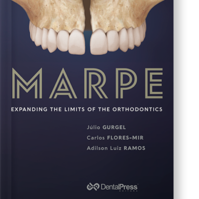 MARPE - EXPANDING THE LIMITS OF ORTHODONTICS(Livro Digital)