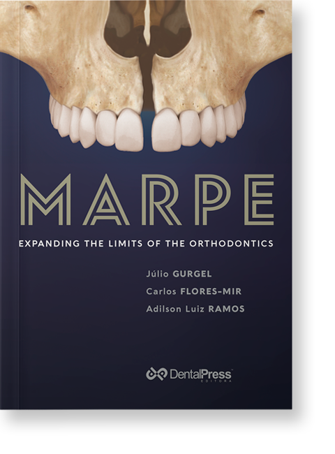 MARPE - EXPANDING THE LIMITS OF ORTHODONTICS(Livro Digital)
