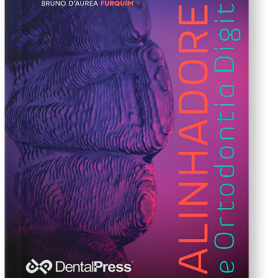 ALINHADORES e Ortodontia Digital (Livro Digital)