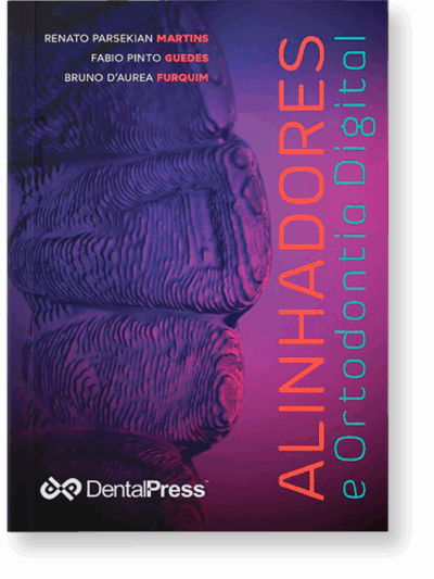 ALINHADORES e Ortodontia Digital (Livro Digital)