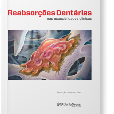 Reabsorções Dentárias nas Especialidades Clínicas