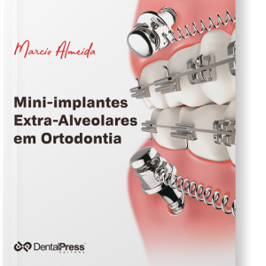 15174432765 capa com sombra Mini Implantes exra alveolares