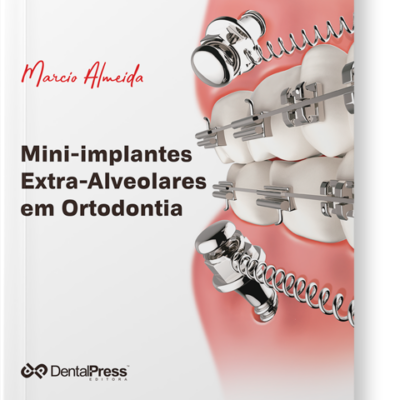 Mini-Implantes Extra-Alveolares Em Ortodontia 2a. Reimpressão/