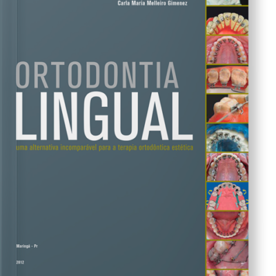 Ortodontia Lingual: Uma alternativa incomparável para a terapia ortodôntica estética