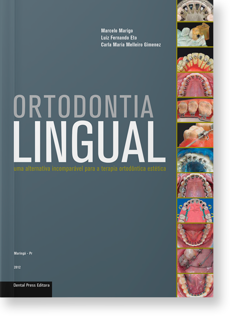 Ortodontia Lingual: Uma alternativa incomparável para a terapia ortodôntica estética