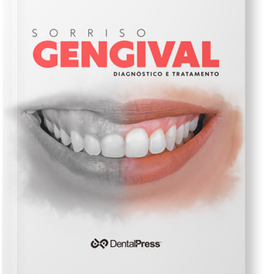 Sorriso Gengival - Dennis Guimarães e Julio Rebollal