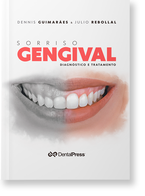 Sorriso Gengival - Dennis Guimarães e Julio Rebollal
