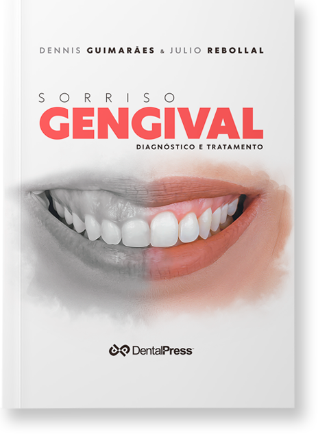 15174433444 CAPA COM SOMBRA sorriso gengival