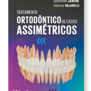 15174433851 TRATAMENTO ASSIMETRICO COM SOMBRA