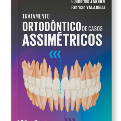 Tratamento Ortodôntico de Casos Assimétricos