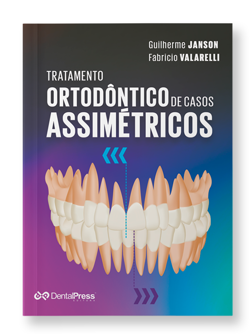 15174433851 TRATAMENTO ASSIMETRICO COM SOMBRA