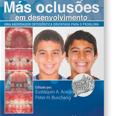 Reconhecendo e Corrigindo Más Oclusões em Desenvolvimento