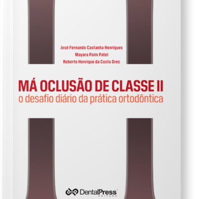 Má Oclusão de Classe II