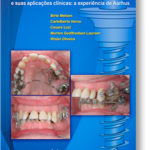 CAPA COM SOMBRA mini implantes