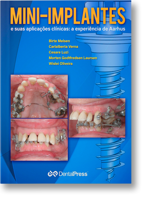 CAPA COM SOMBRA mini implantes