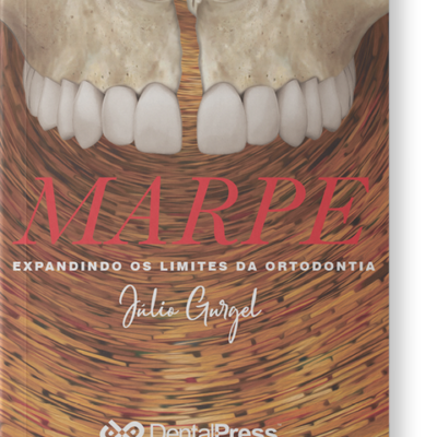 Marpe: Expandindo os Limites da Ortodontia 1ª edição