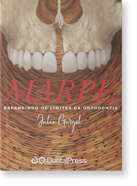 Marpe: Expandindo os Limites da Ortodontia 1ª edição