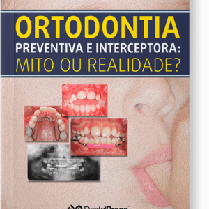 Ortodontia Preventiva