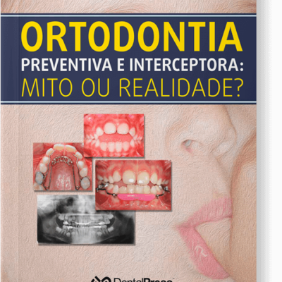 Ortodontia Preventiva e Interceptora: Mito ou Realidade?