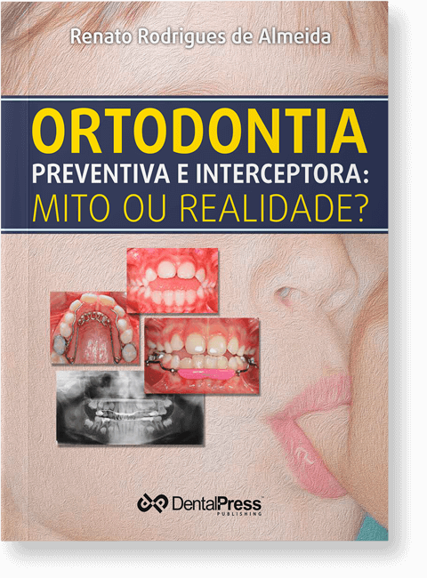 Ortodontia Preventiva e Interceptora: Mito ou Realidade?