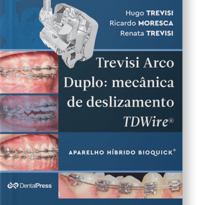 Trevisi Arco Duplo - mecânica de deslizamento TDWire