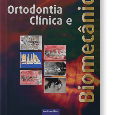 Ortodontia Clínica e Biomecânica