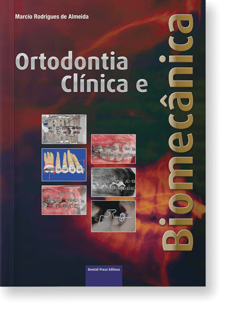 Ortodontia Clínica e Biomecânica