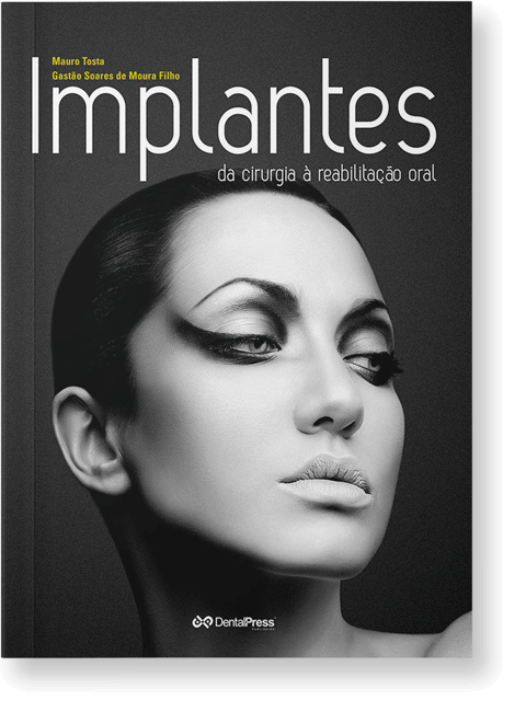 capa implantes