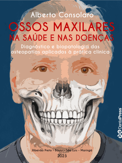 Livro ossos maxilares na saúde e nas doenças - Prof Alberto Consolaro
