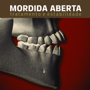 Ebook Mordida Aberta DentalGo Capa 1