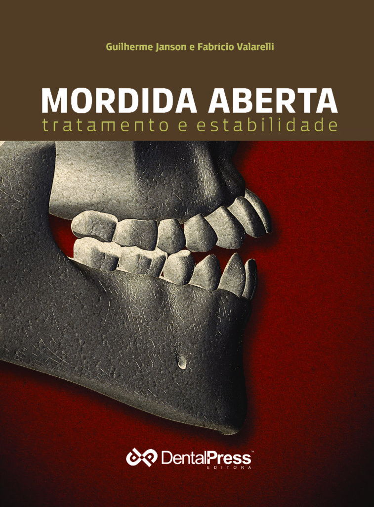 Mordida Aberta Tratamento e Estabilidade Dental Press Books