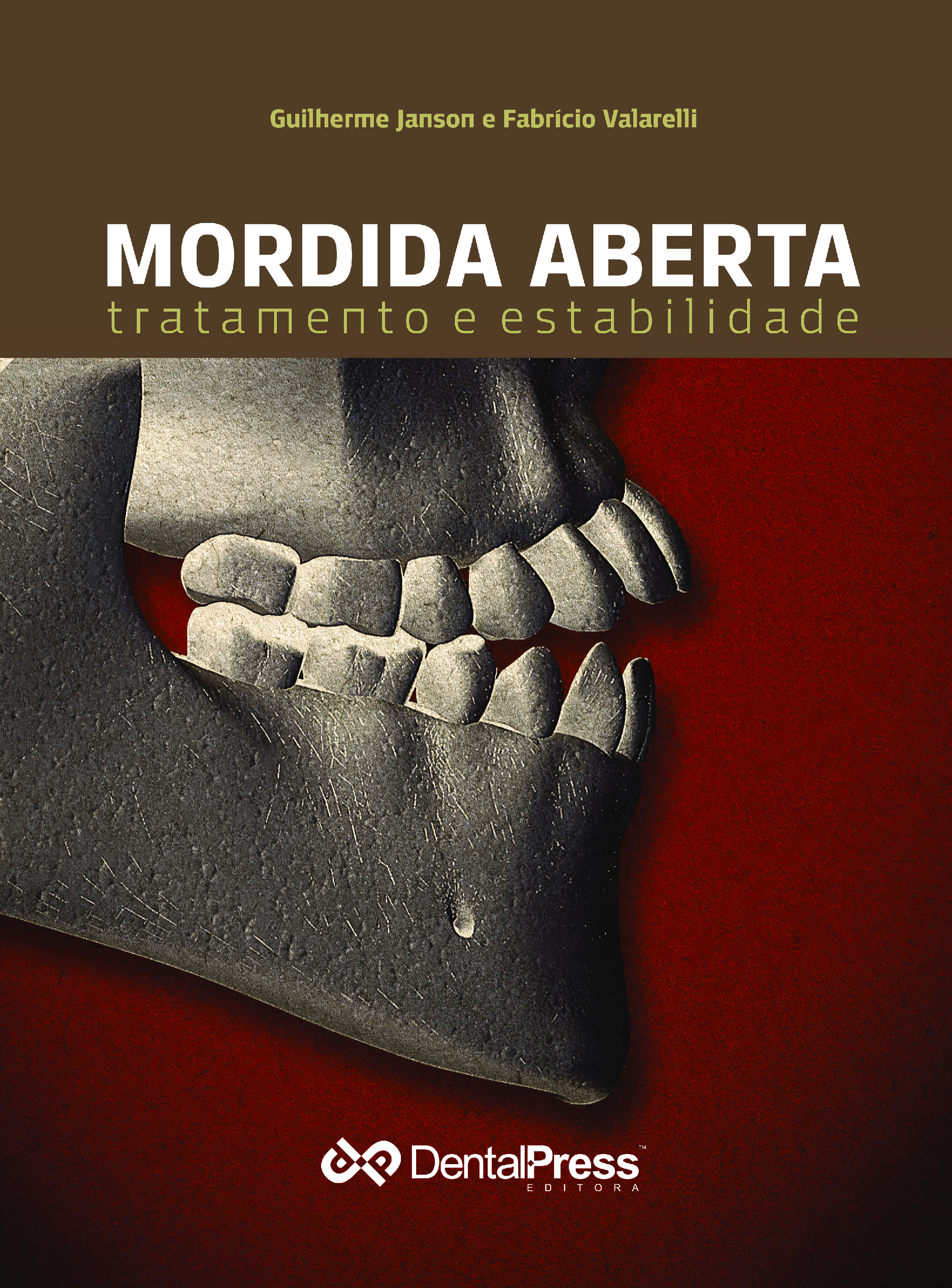 Ebook Mordida Aberta DentalGo Capa 1