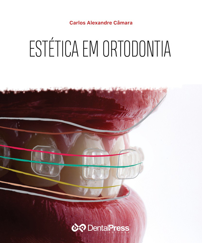 Capa Estetica Em Ortodontia