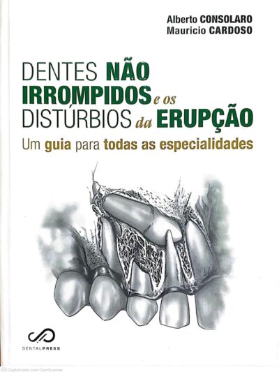 Página Inicial 14 Dentes não irrompidos e os distúrbios da erupção - Um guia para todas as especialidades