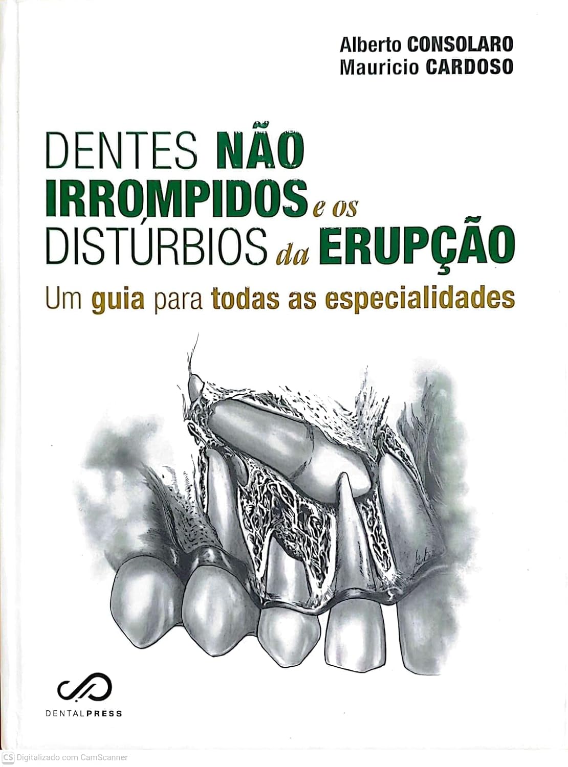 capa dentes nao irrompidos.jpg